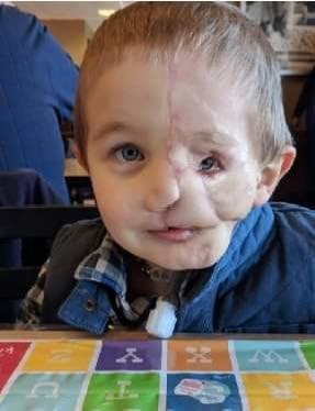 5-Year-Old Boy Survives Dog Attack but Faces Cruel Bullying