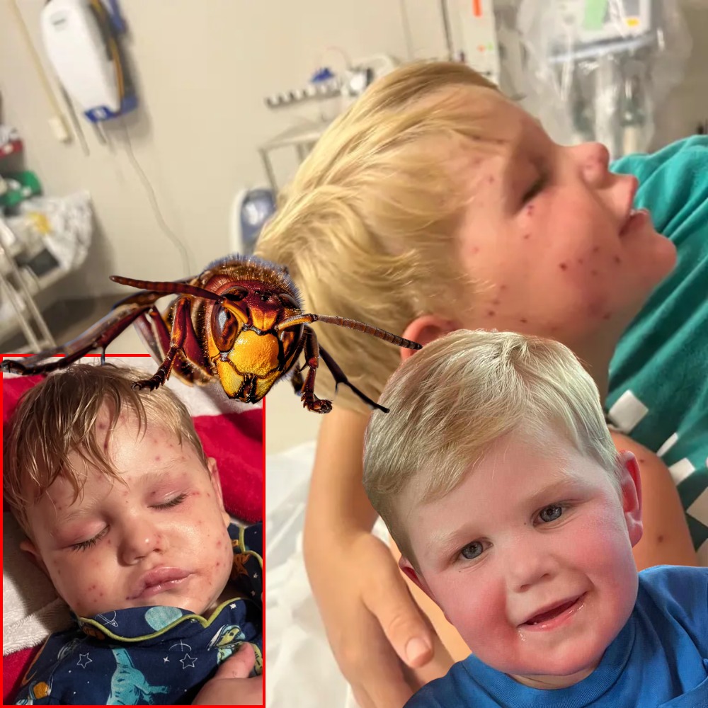 Georgia Toddler, 2, Is on Life Support After Being Stung Over 150 Times by Yellowjackets