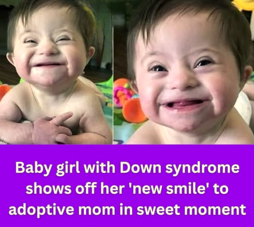 Adopted Baby with Down Syndrome Captures Hearts Online After Smiling at Mom