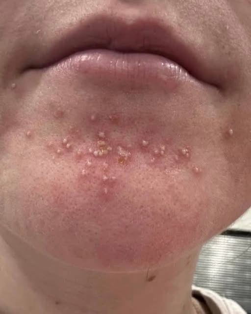This Is What Can Happen When You Sleep With the Wrong Person… See more