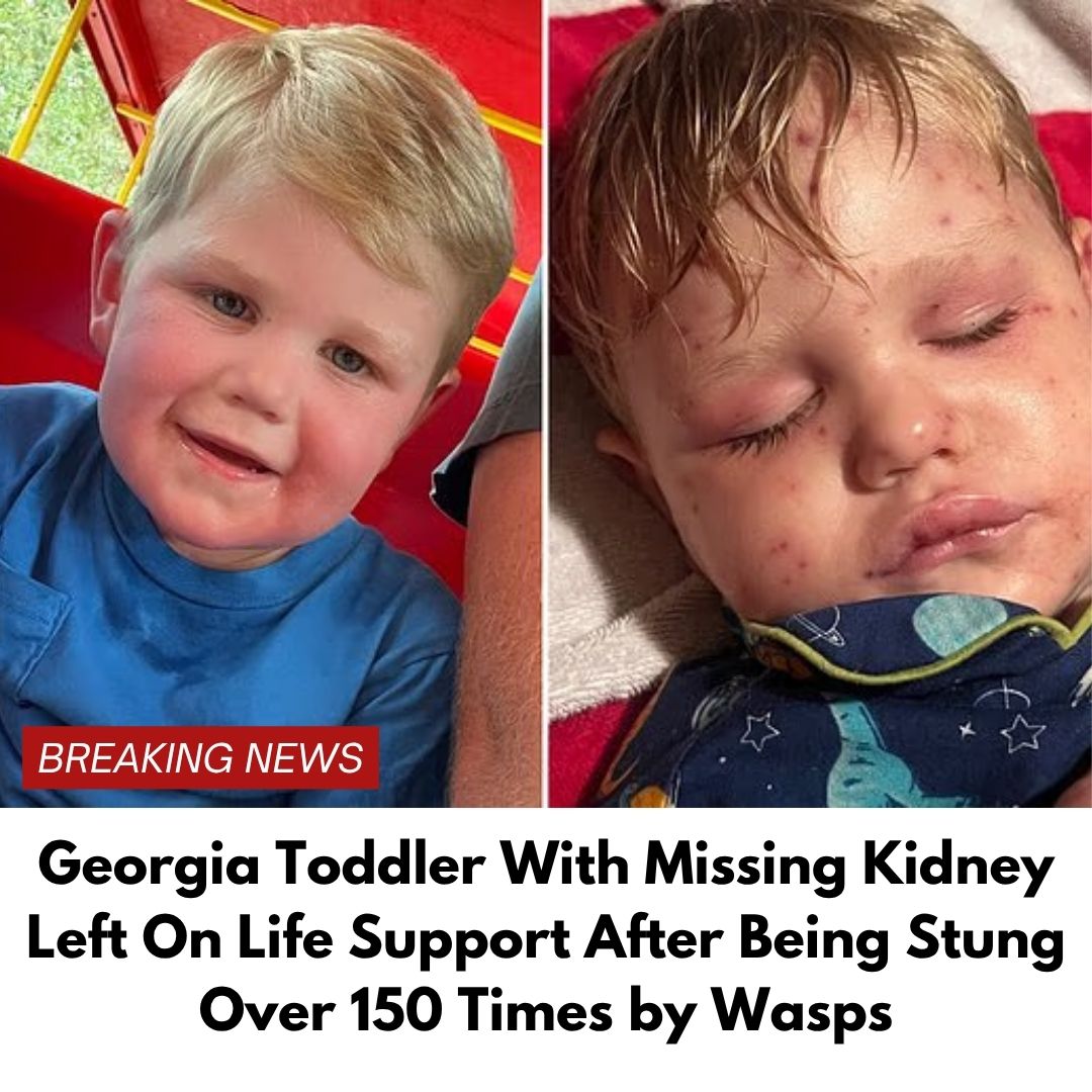Georgia Toddler Stung Over 150 Times by Yellow Jackets, Fighting for His Life