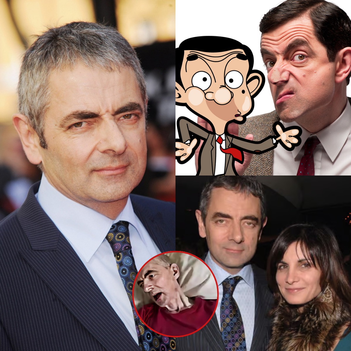 BREAKING: Just half an hour ago, the beloved comedian Rowan Atkinson, famously known as Mr. Bean, was reported by his wife to be courageously facing a serious health challenge at the age of 70…