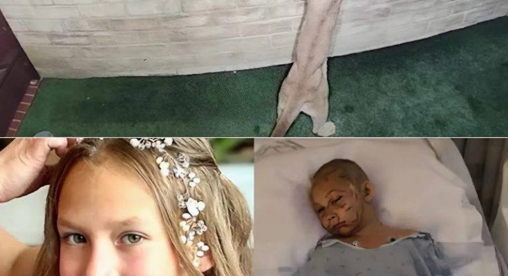 An ordinary day in Malibu turned into a nightmare when an 11-year-old girl was suddenly @tt@ck3d by a mountain lion right outside her home. Out of nowhere,…-TT