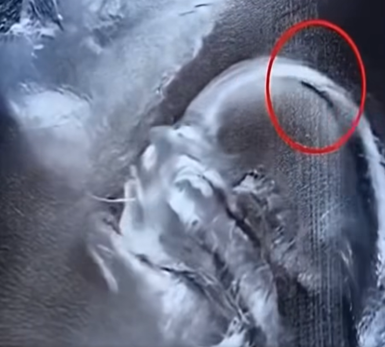 What Doctors Saw on the Ultrasound Left Them in Awe