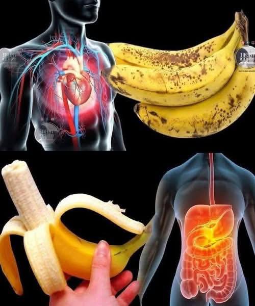 The Shocking Truth About Bananas What Doctors Wish You Knew Before You Peel Another One