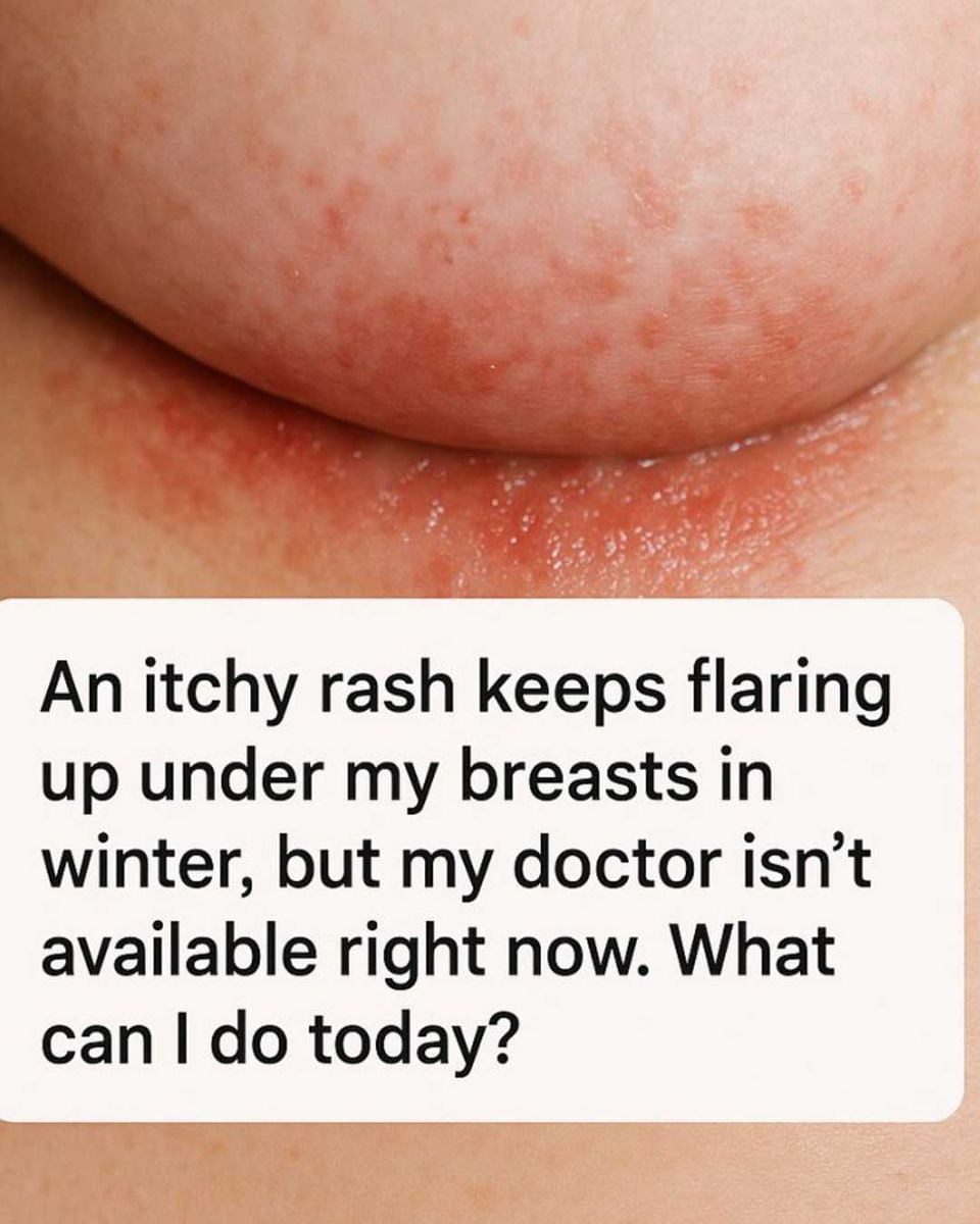 The winter rash under your breasts might be trying to tell you something important