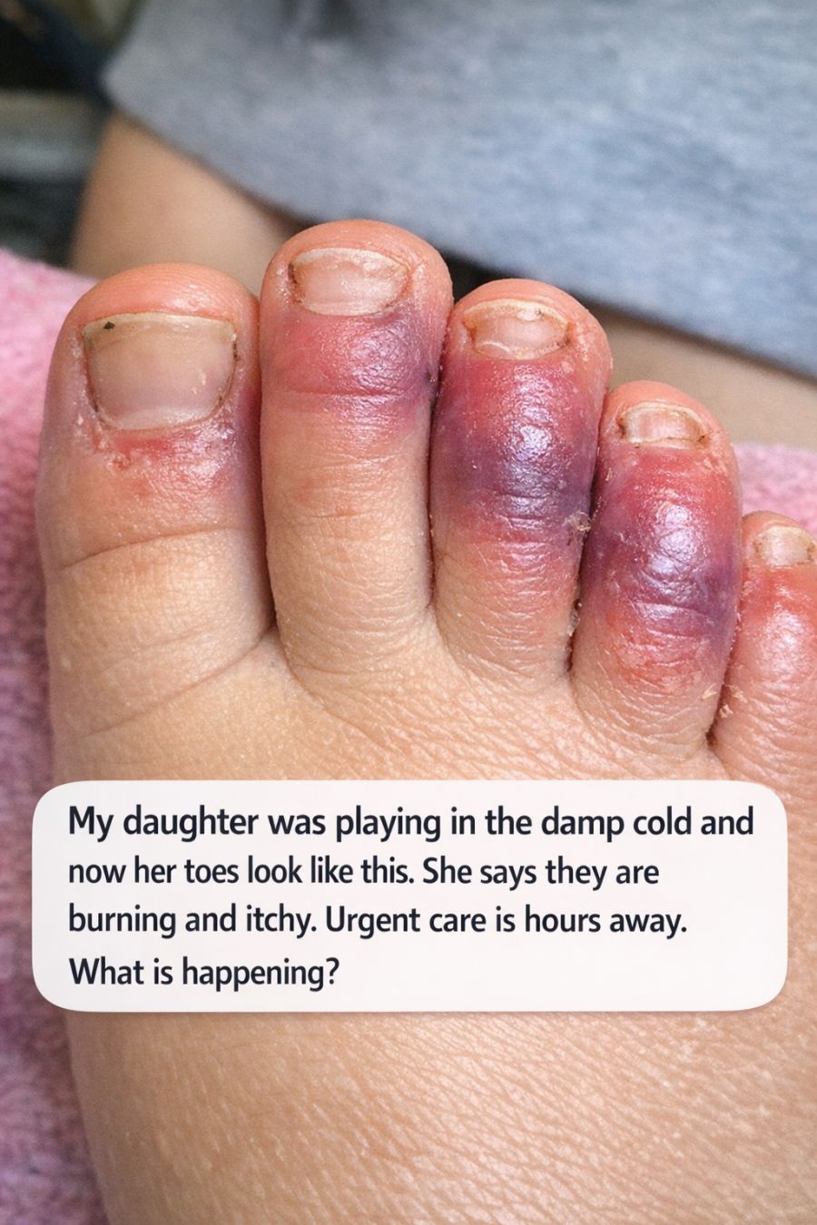 Her Toes Turned Red and Burning After Playing Outside What It Really Means Could Surprise You
