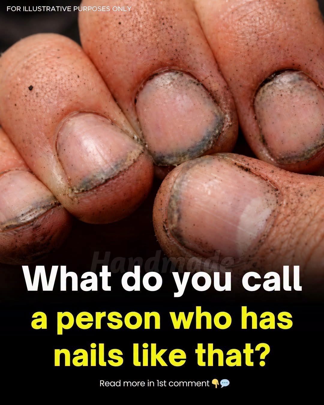What Dirty Fingernails Might Really Say About a Person